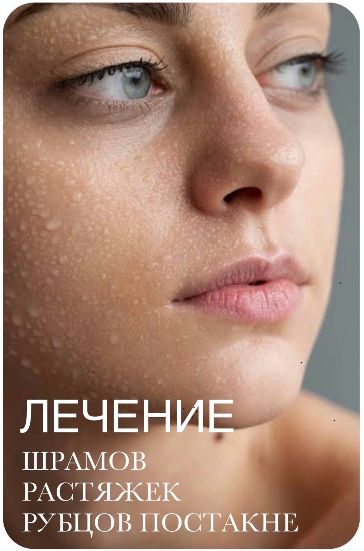 Предлагается процедура коллагенотерапии (микроигольчатая) для лечения…