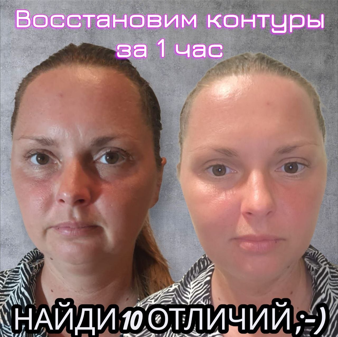 Предлагается уникальный массаж лица, обучение в Таиланде