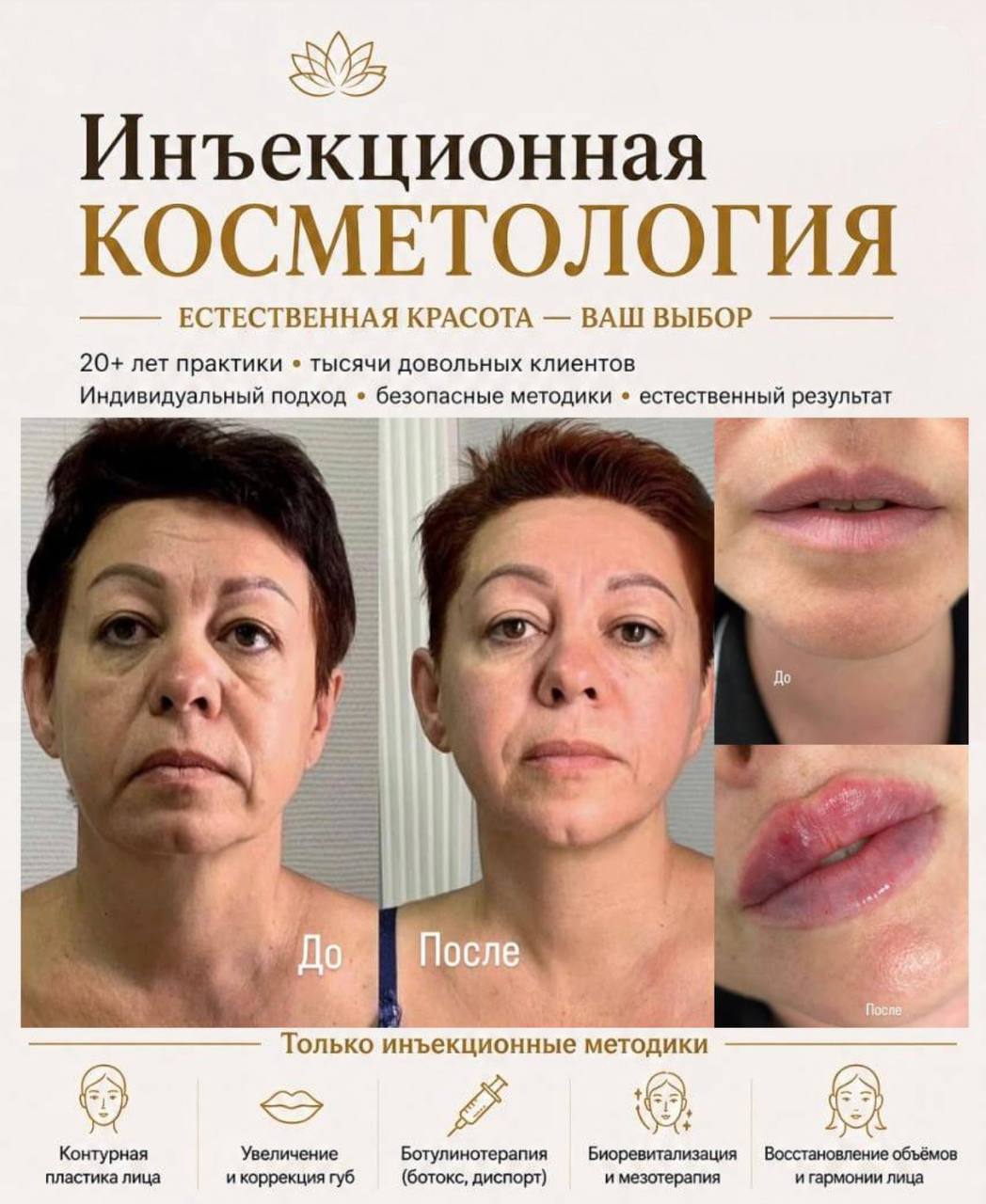 Предлагаются услуги инъекционной косметологии: контурная пластика, уве